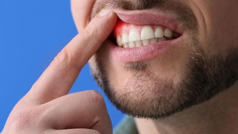 Diş Eti Tedavisi Dekadent Darıca Ağız ve Diş Sağlığı Polikliniği