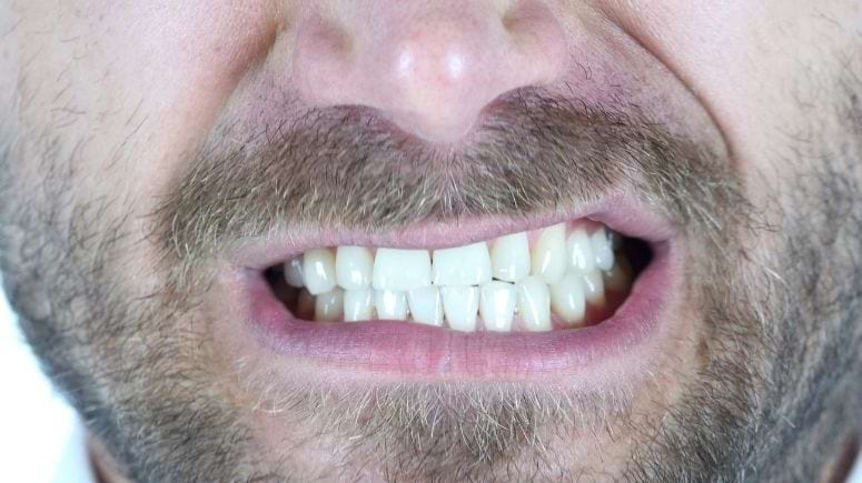 Diş Gıcırdatma ve Tedavi Seçenekleri nelerdir