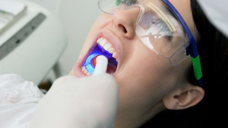 Dolgu İşlemleri Dekadent Darıca Ağız ve Diş Sağlığı Polikliniği